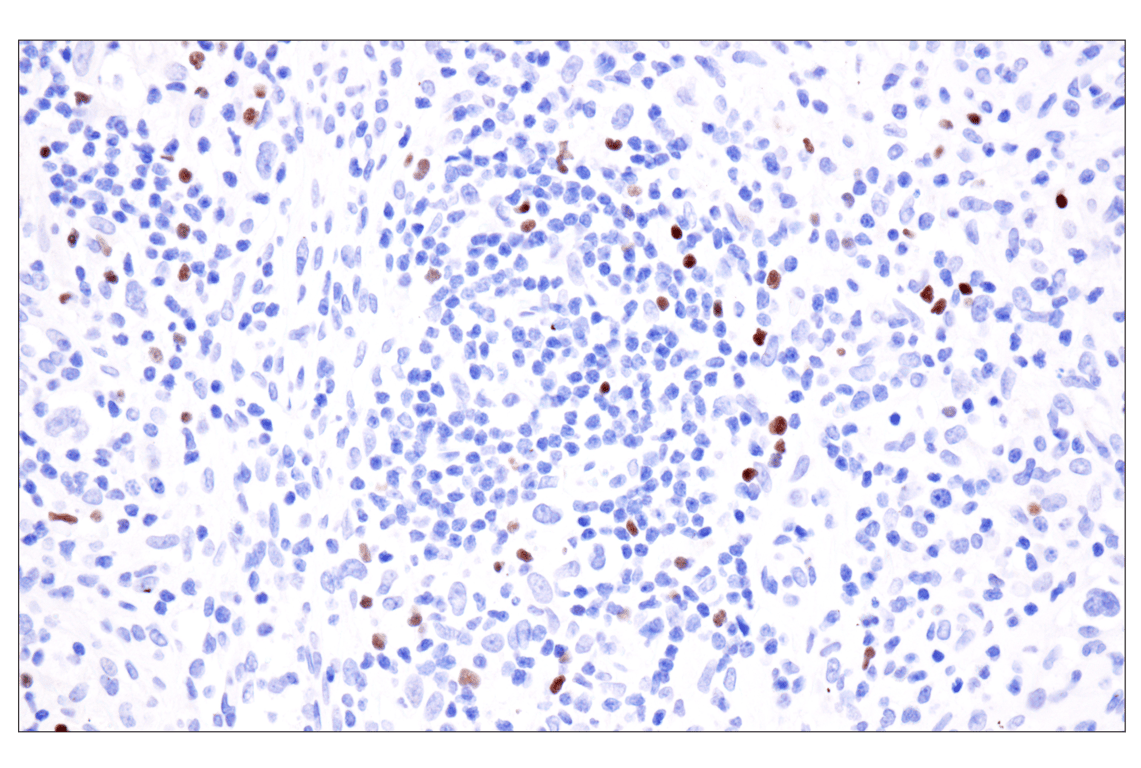 Immunohistochemistry Image 4: FoxP3 (221D) Mouse Monoclonal Antibody