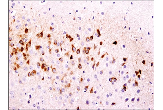 Immunohistochemistry Image 2: CART (D6M2M) Rabbit Monoclonal Antibody