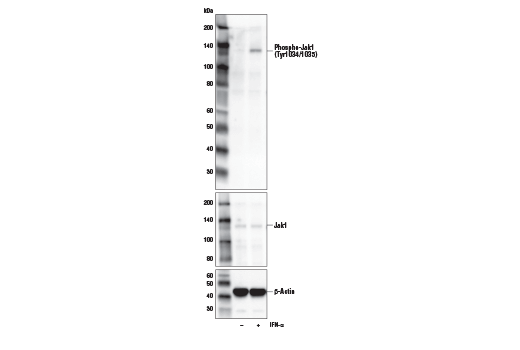Western Blotting Image 2: Phospho-Jak1 (Tyr1034/1035)/Jak2 (Tyr1007/1008) (E9Y7V) Mouse Monoclonal Antibody