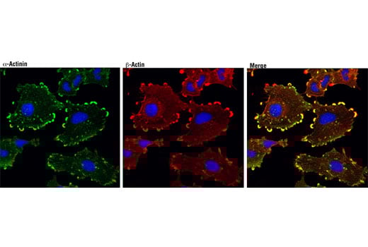 Immunofluorescence Image 1: alpha-Actinin (D6F6) Rabbit Monoclonal Antibody