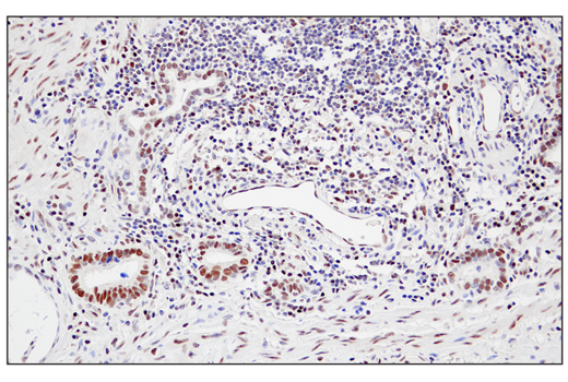 Immunohistochemistry Image 2: JMJD6 (D3O3N) Rabbit Monoclonal Antibody
