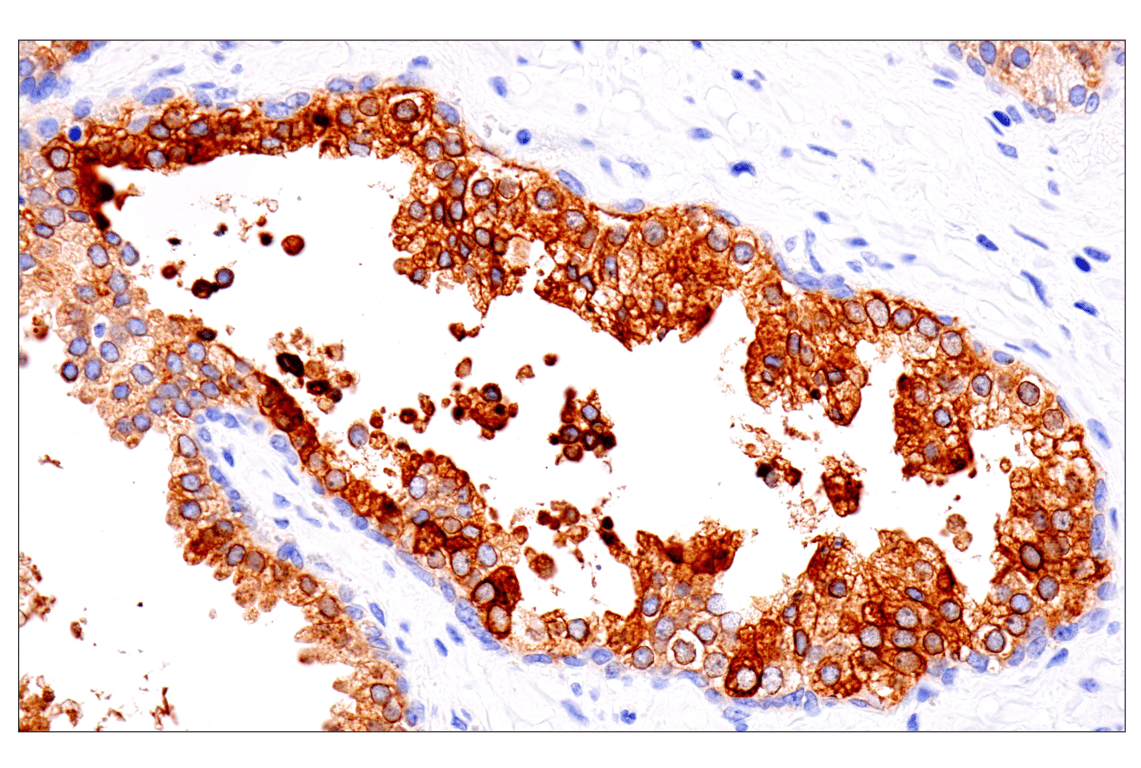 Immunohistochemistry Image 3: ENTPD5 (E5U3V) Rabbit Monoclonal Antibody