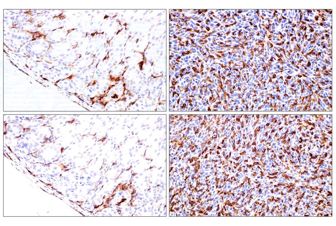 CD11b/ITGAM (E4K8C) Rabbit mAb | Cell Signaling Technology