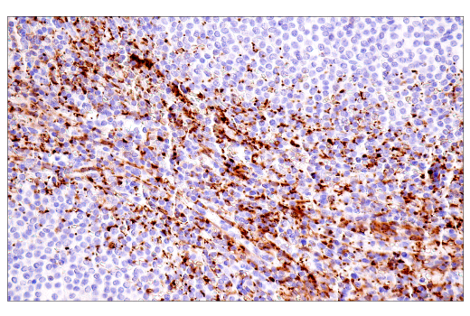 undefined Image 22: Genetics of Parkinson's Disease: Lysosomal Dysfunction Antibody Sampler Kit