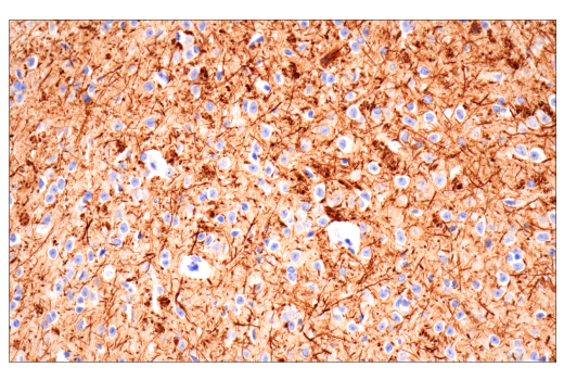 Immunohistochemistry Image 1: Neurofilament-H (E7Z7G) Rabbit Monoclonal Antibody