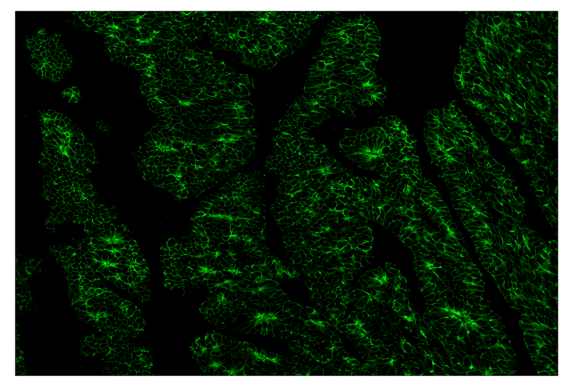 Immunohistochemistry Image 2: E-Cadherin (24E10) & CO-0103-647 SignalStar<sup>™</sup> Oligo-Antibody Pair