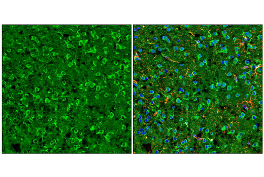 Immunofluorescence Image 3: ApoE (E7X2A) Rabbit Monoclonal Antibody