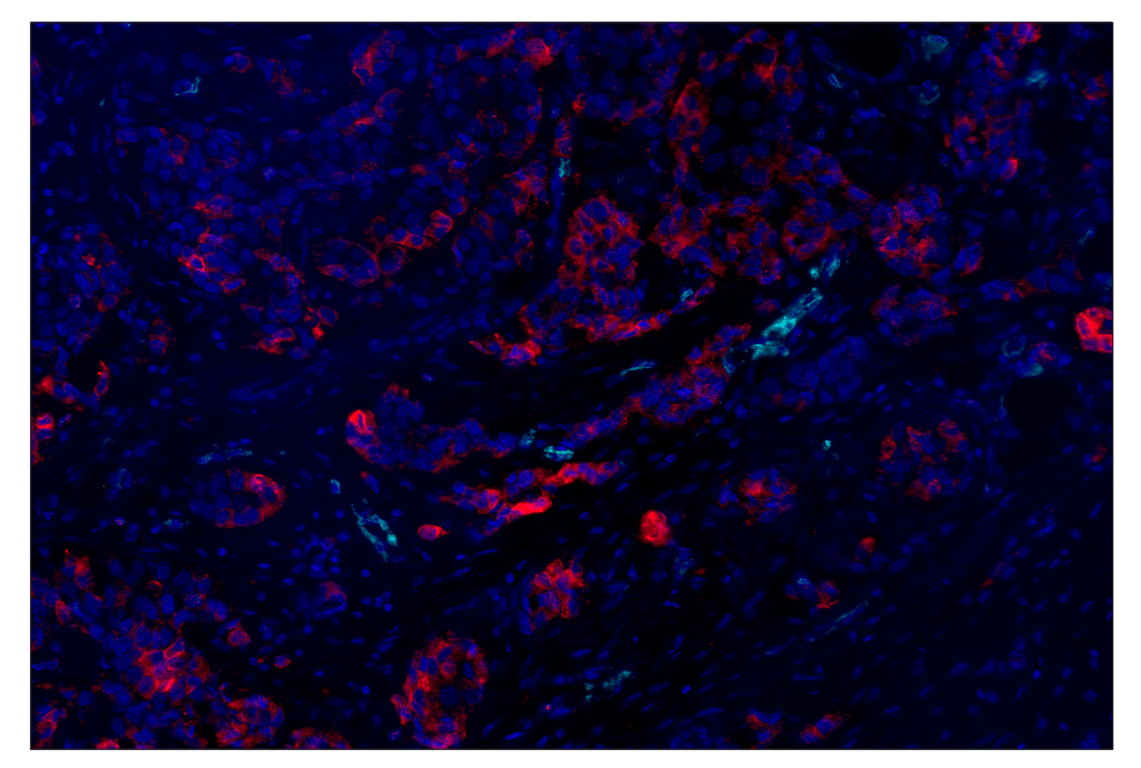 Immunohistochemistry Image 1: CD36 (D8L9T) & CO-0228-750 SignalStar<sup>®</sup> Oligo-Antibody Pair