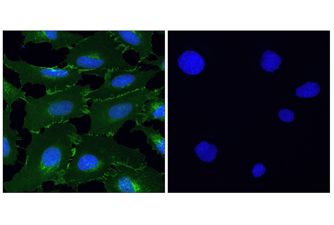 Immunofluorescence Image 1: beta-Catenin (D10A8) Rabbit Monoclonal Antibody (BSA and Azide Free)