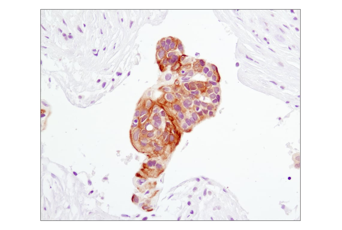 undefined Image 3: PhosphoPlus<sup>®</sup> Akt (Ser473) Antibody Duet