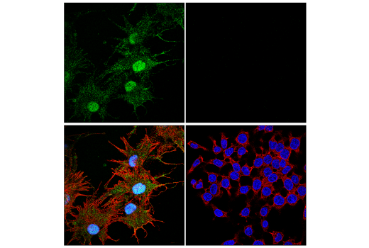 undefined Image 6: Genetics of Parkinson's Disease: Lysosomal Dysfunction Antibody Sampler Kit