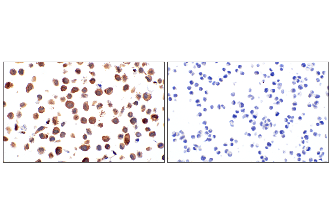 Immunohistochemistry Image 14: TFE3 (F3Z2Q) Rabbit Monoclonal Antibody