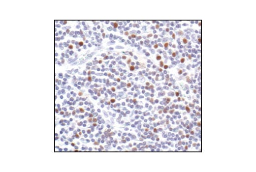 Immunohistochemistry Image 3: PCNA (PC10) Mouse Monoclonal Antibody