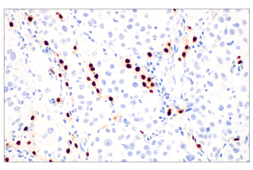 Immunohistochemistry Image 2: Thyroid Transcription Factor 1 (TTF-1) (SPT24) Mouse Monoclonal Antibody