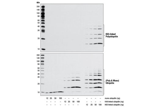 undefined Image 9: Branched Ubiquitin Antibody Sampler Kit