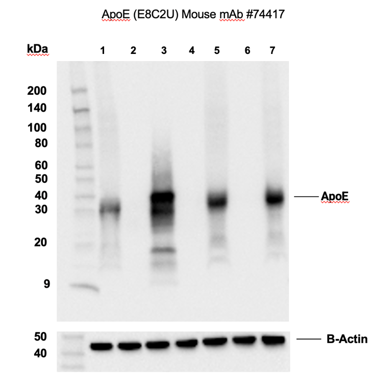 Western Blotting Image 2: ApoE (pan) (E8C2U) Mouse Monoclonal Antibody