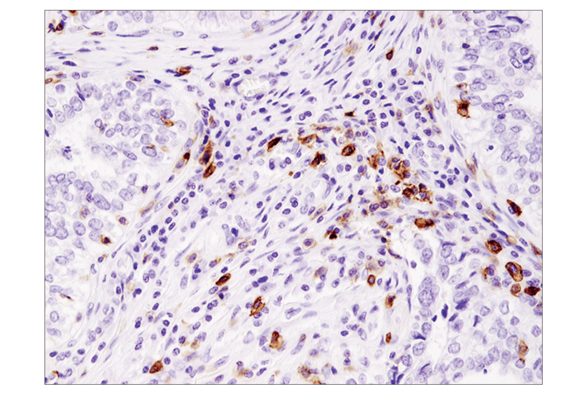 Immunohistochemistry Image 2: ICOS (D1K2T<sup>™</sup>) Rabbit Monoclonal Antibody (BSA and Azide Free)