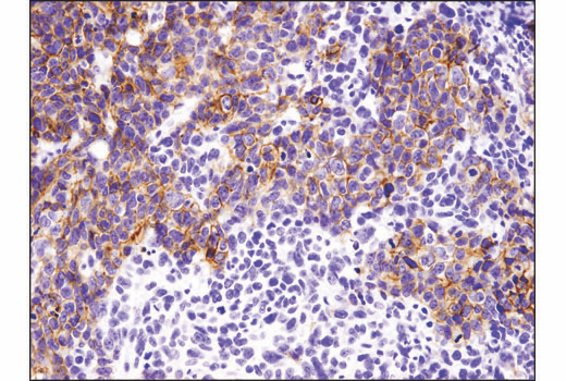 Immunohistochemistry Image 2: E-Cadherin (4A2) Mouse Monoclonal Antibody (BSA and Azide Free)
