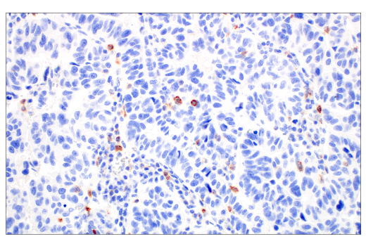 Immunohistochemistry Image 1: CD70 (E3Q1A) Rabbit Monoclonal Antibody (BSA and Azide Free)