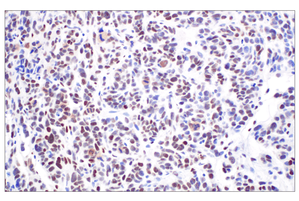 Immunohistochemistry Image 3: TCF4/ITF2 (E3X2Y) Rabbit Monoclonal Antibody
