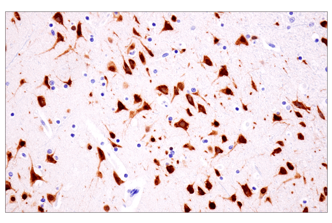 undefined Image 25: beta-Amyloid Mouse Model Neuronal Viability IF Antibody Sampler Kit