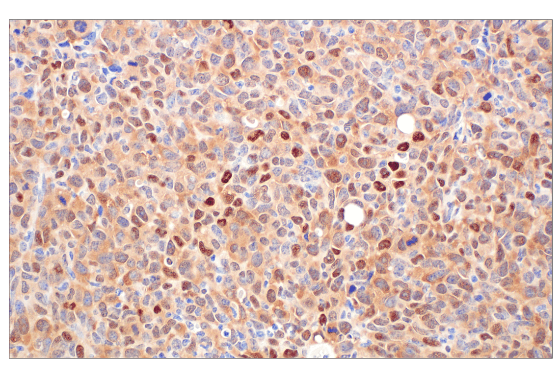 Immunohistochemistry Image 9: CDK4 (F8L5F) Rabbit Monoclonal Antibody