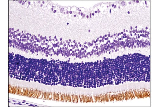 Immunohistochemistry Image 2: Rhodopsin (D4B9B) Rabbit Monoclonal Antibody