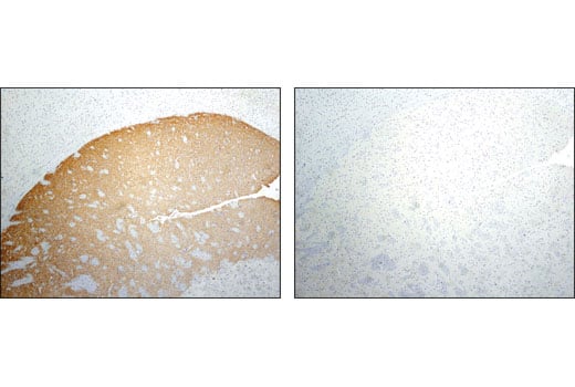 Immunohistochemistry Image 2: Phospho-Tyrosine Hydroxylase (Ser31) (D6I9V) Rabbit Monoclonal Antibody