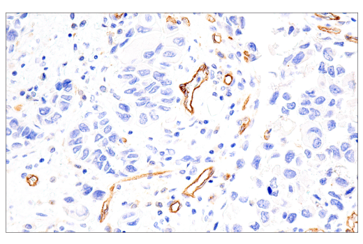 Immunohistochemistry Image 3: IL3RA/CD123 (BR4MS) Mouse Monoclonal Antibody