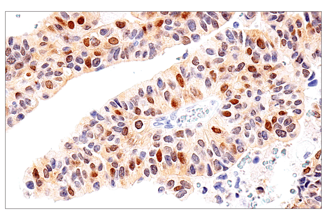 Immunohistochemistry Image 6: Chk1 (2G1D5) Mouse mAb