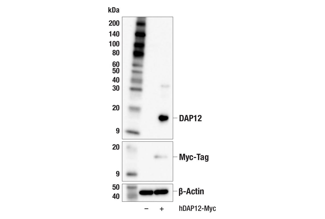 Western Blotting Image 2: DAP12 (F1Q2P) Rabbit Monoclonal Antibody