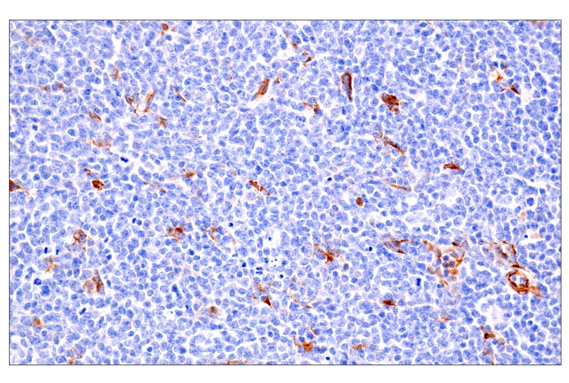 Immunohistochemistry Image 2: HSP47/SERPINH1 (E4A8P) Rabbit Monoclonal Antibody