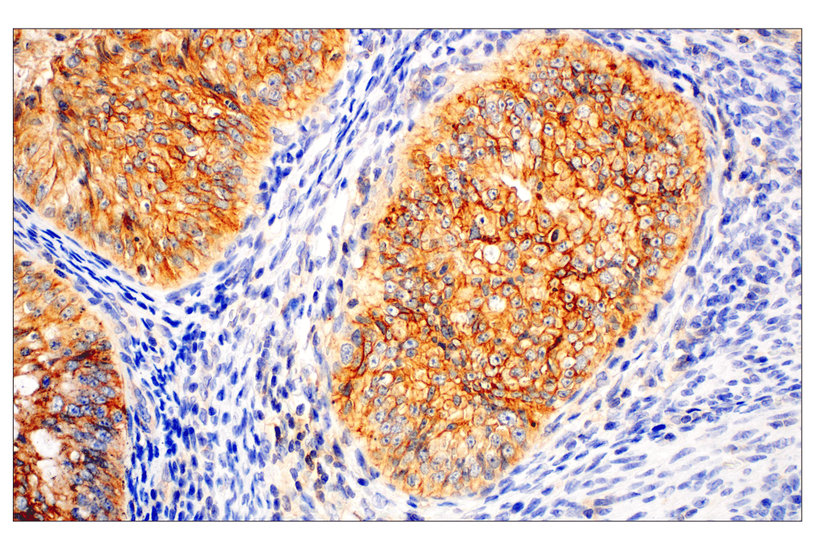 Immunohistochemistry Image 1: CMTM6 (E6A8T) Rabbit Monoclonal Antibody