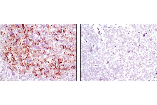 Immunohistochemistry Image 6: Phospho-S6 Ribosomal Protein (Ser240/244) (D68F8) Rabbit Monoclonal Antibody