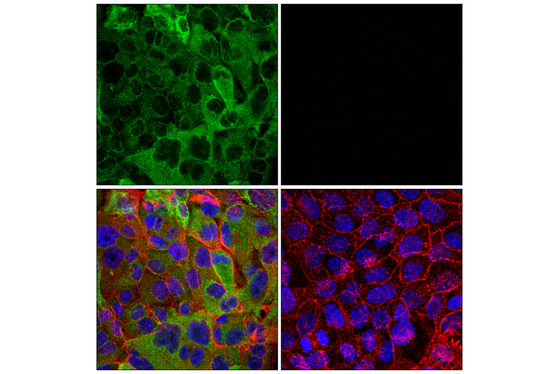 Immunofluorescence Image 1: MBOAT2 (F8Z4U) Rabbit Monoclonal Antibody