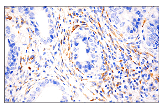 Immunohistochemistry Image 2: LOXL2 (E3P7Y) Rabbit Monoclonal Antibody (BSA and Azide Free)
