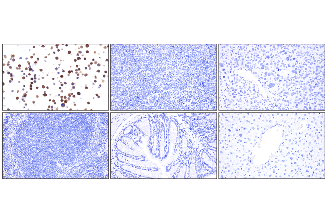 Immunohistochemistry Image 4: Whitlow/218 Linker (F2G3S) Rabbit Monoclonal Antibody