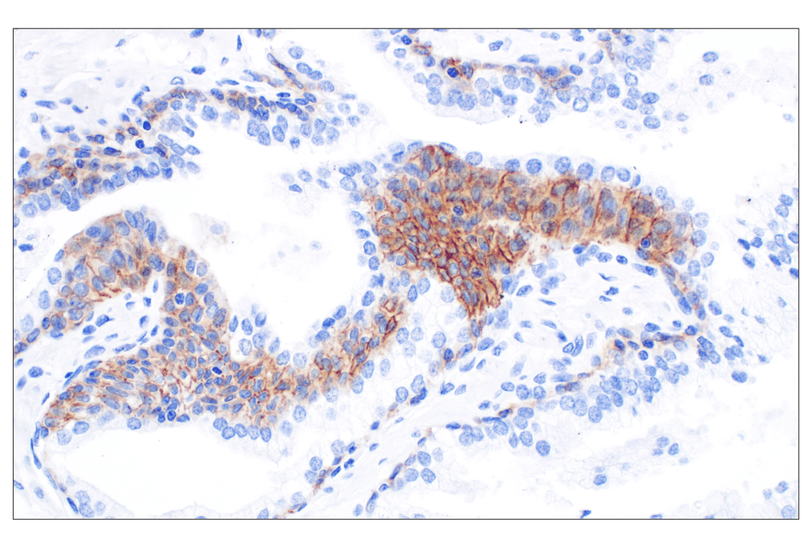 Immunohistochemistry Image 6: CD44 v5 (C44Mab-3) Mouse Monoclonal Antibody