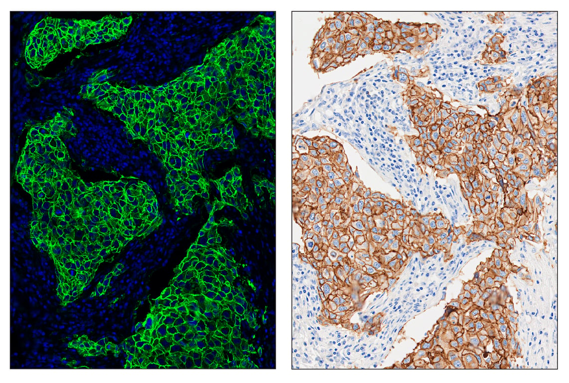 Immunohistochemistry Image 6: HER2/ErbB2 (D8F12) & CO-0019-488 SignalStar<sup>™</sup> Oligo-Antibody Pair
