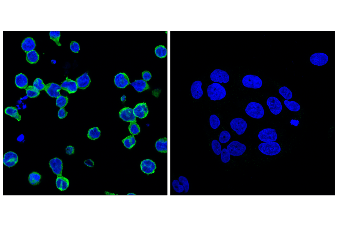 Immunofluorescence Image 1: SHIP1 (C40G9) Rabbit Monoclonal Antibody (BSA and Azide Free)
