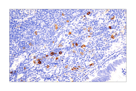 Immunohistochemistry Image 2: TNFRSF8/CD30 (E7E4D) Rabbit Monoclonal Antibody (BSA and Azide Free)