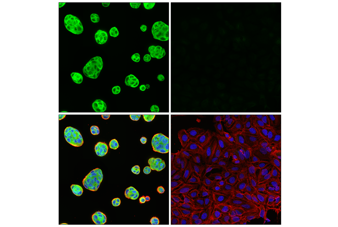 Immunofluorescence Image 1: VAPB (E7R3Z) Rabbit Monoclonal Antibody
