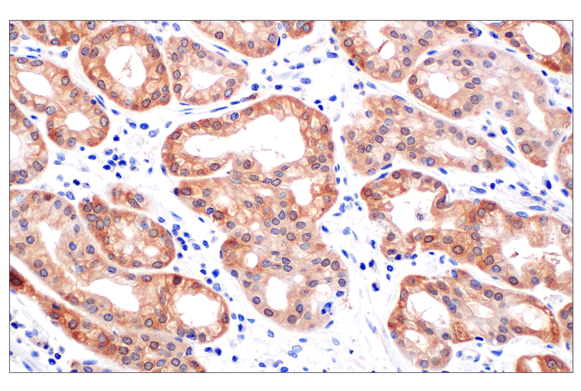 Immunohistochemistry Image 1: PIP4K2C (E7P3S) Rabbit Monoclonal Antibody