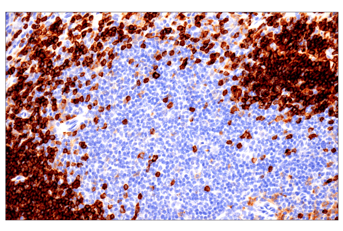 Immunohistochemistry Image 2: CD22 (F9D1W) Rabbit Monoclonal Antibody