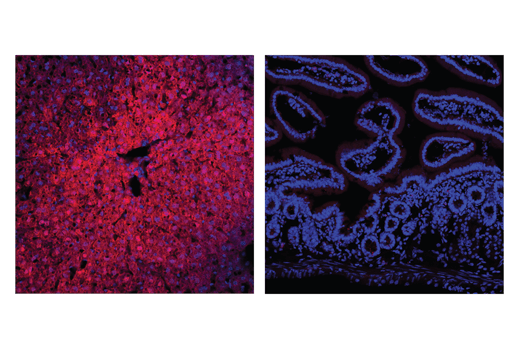 Immunofluorescence Image 1: Arginase-1 (D4E3M<sup>™</sup>) XP<sup>®</sup> Rabbit mAb (Alexa Fluor<sup>®</sup> 647 Conjugate)