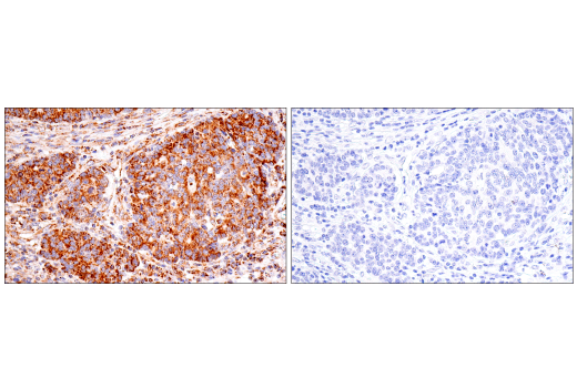 Immunohistochemistry Image 16: SDHB (E3H9Z) Rabbit Monoclonal Antibody