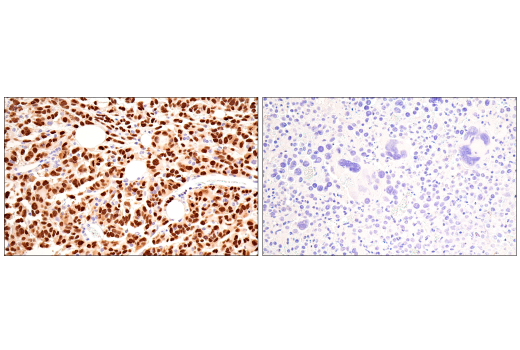 Immunohistochemistry Image 5: Olig2 (E6G6Q) Rabbit Monoclonal Antibody