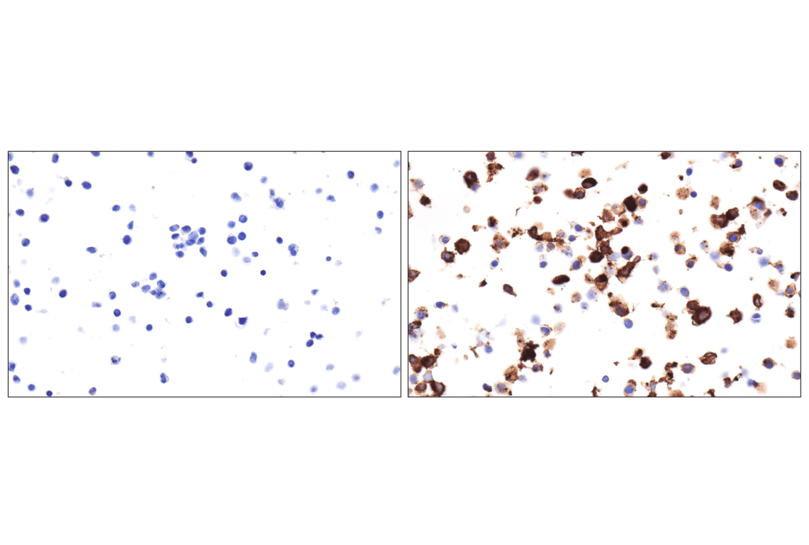 Immunohistochemistry Image 5: LAMP3/CD208 (E8T2T) Rabbit Monoclonal Antibody