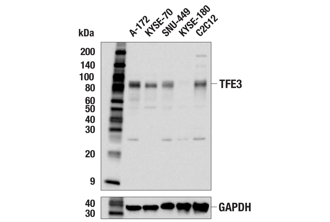 Western Blotting Image 3: TFE3 (E6T9M) Rabbit Monoclonal Antibody