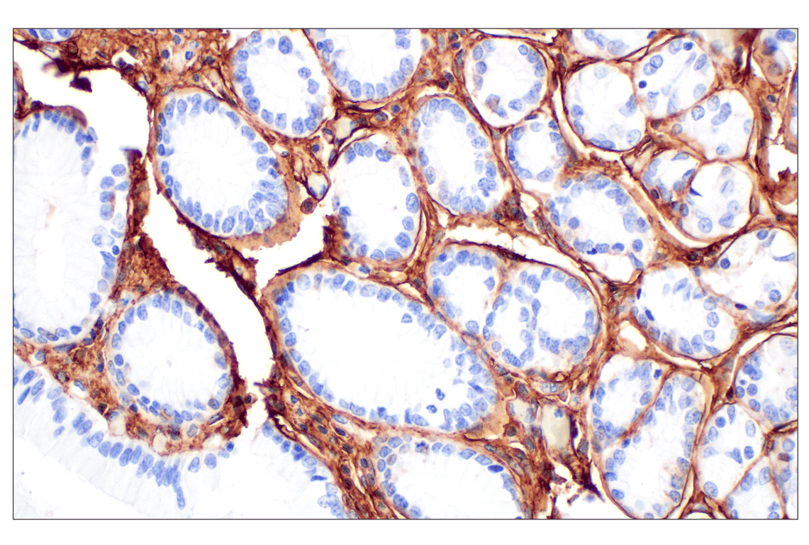 Immunohistochemistry Image 7: Hyaluronan Complete Tissue Staining Kit (HRP)